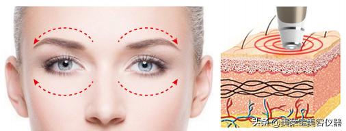 郑州治疗黑眼圈美容院,禹州治疗黑眼圈美容院