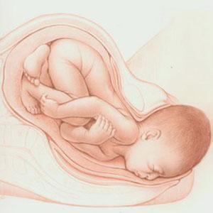 顺产好处那么多，准妈妈快来了解一下！