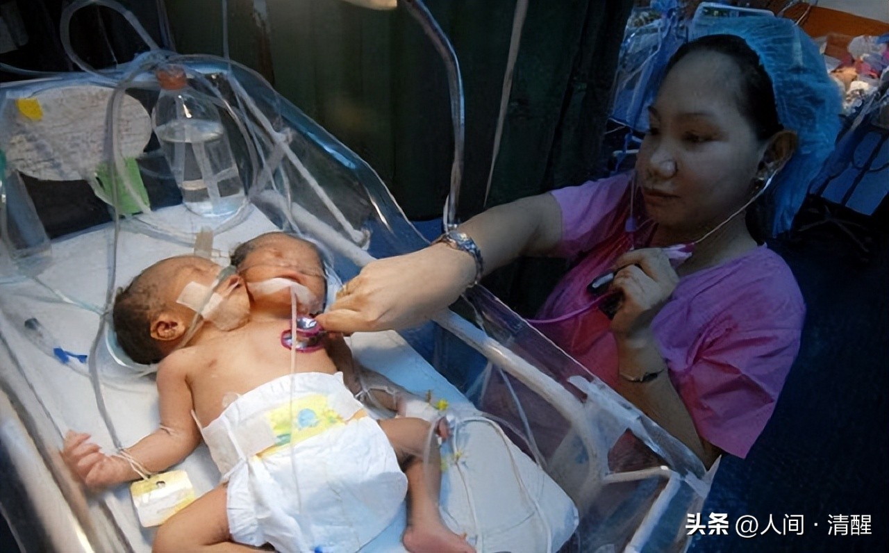 女孩去做体检发现怀了四胞胎,女子怀双胞胎竟是被遗传