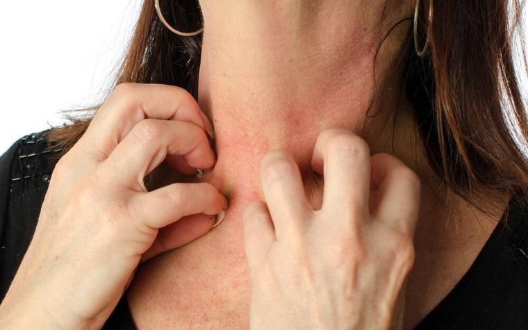 血糖高新药物,血糖稍偏高的中成药