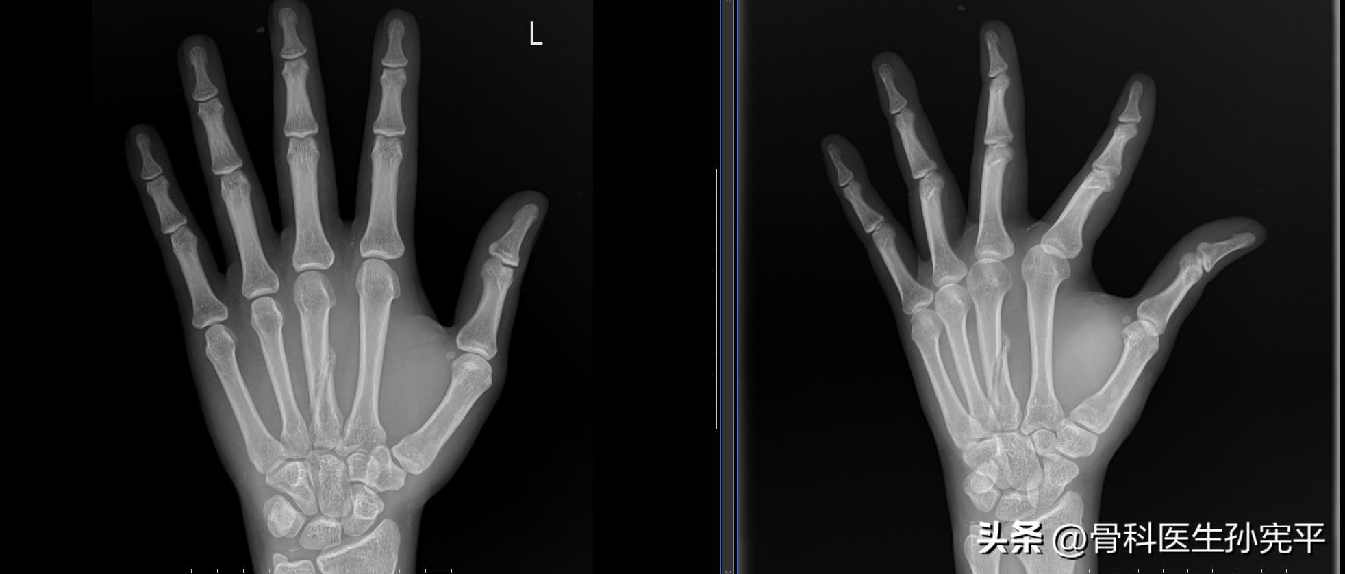 医学影像趣图,震撼的医学影像