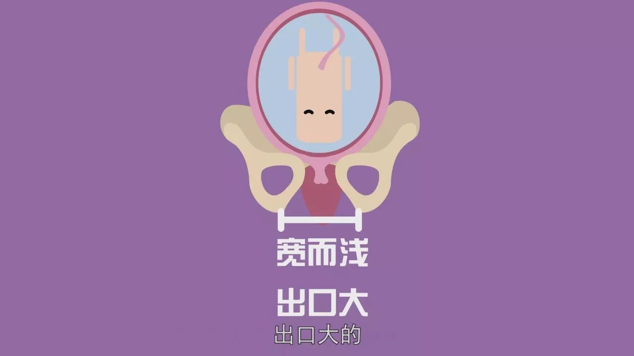 无痛分娩会有腰痛后遗症么,无痛分娩针对孕妇有什么风险