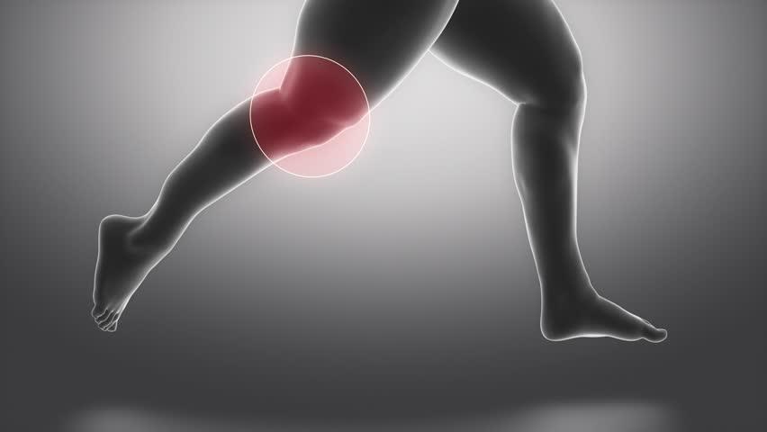 膝盖关节软骨疼痛怎么办,膝关节软骨疼痛的症状