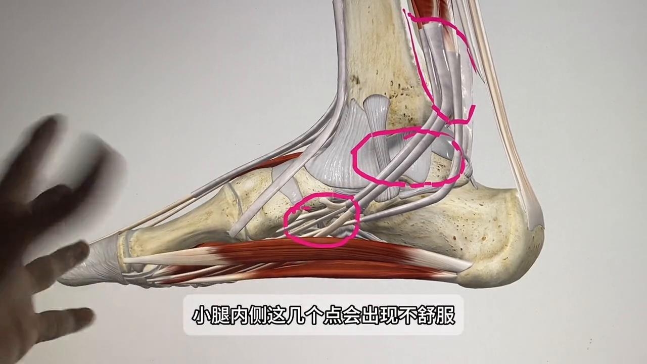 小腿脚踝内侧疼怎么回事,跑步后小腿内侧脚踝疼