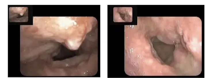 一觉醒来嗓子哑了不能说话,一觉醒来嗓子哑了也不疼