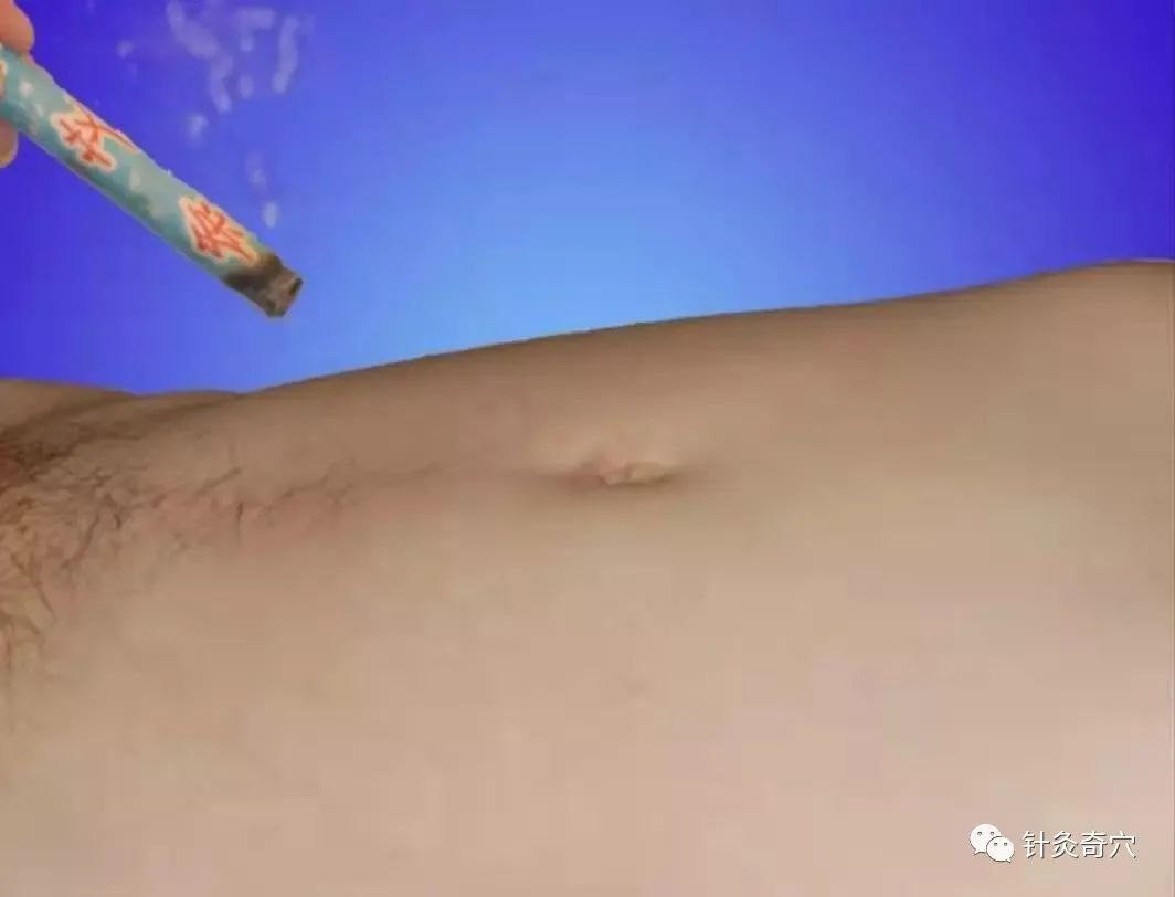 史上最全中医针灸视频教程全集,针灸治疗真实图片大全