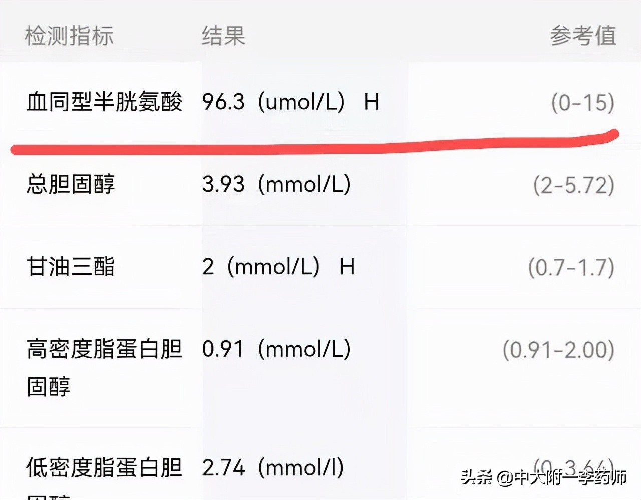 血同型半胱氨酸偏高的意义,血同型半胱氨酸高的危害