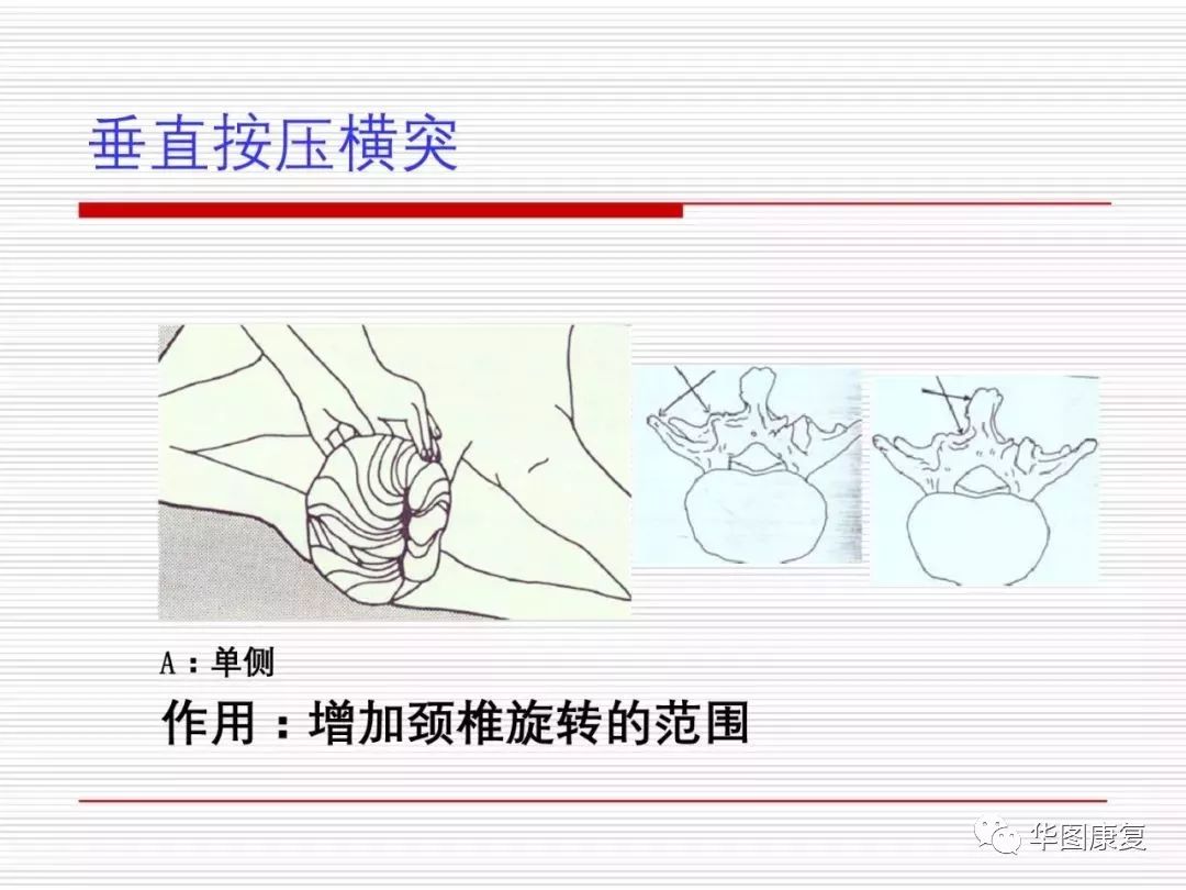 颈复康治疗颈源性头痛吗,颈源性头痛整体解决方案