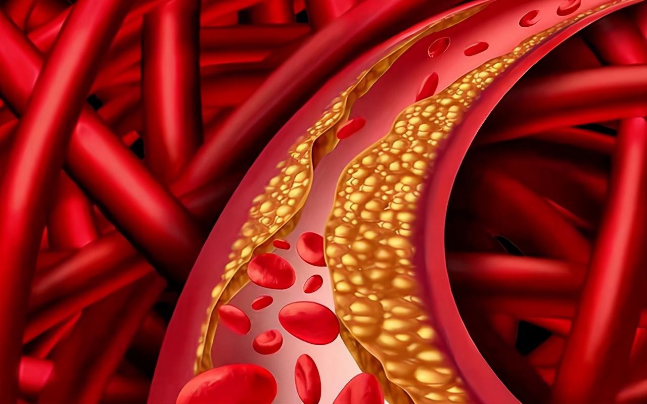 过敏性紫癜一走路就反复怎么回事,儿童过敏性紫癜多久不复发为痊愈