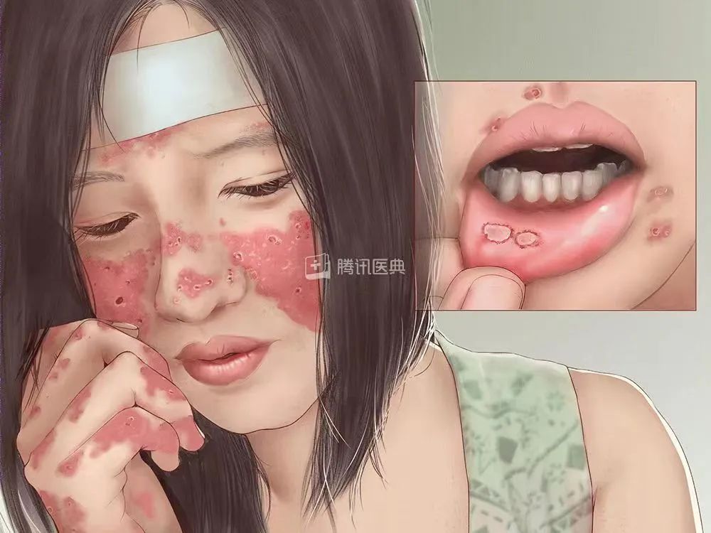 我的肚子中间有一条缝,我的肚子上为何有条竖线