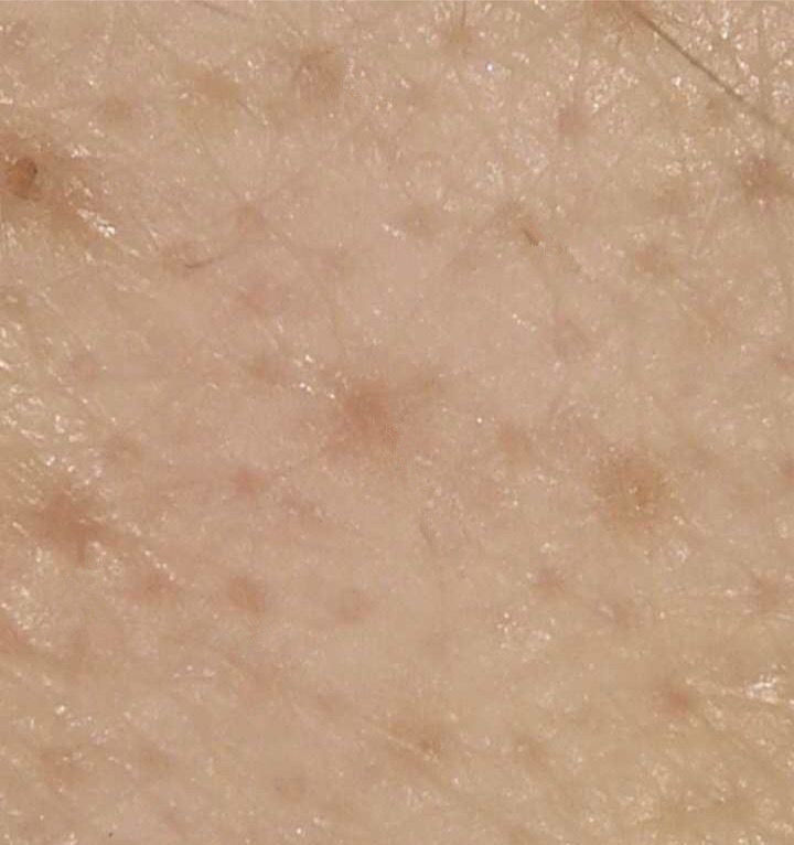 上完粉底液鼻子上有白点,涂粉底液后毛孔有白点点