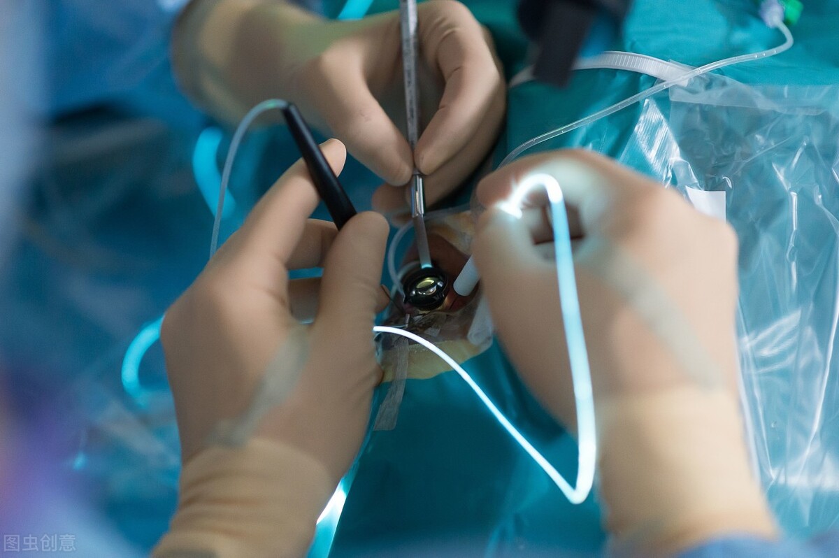 从中医的角度解说视网膜脱落,眼科手术不当会导致视网膜脱落吗