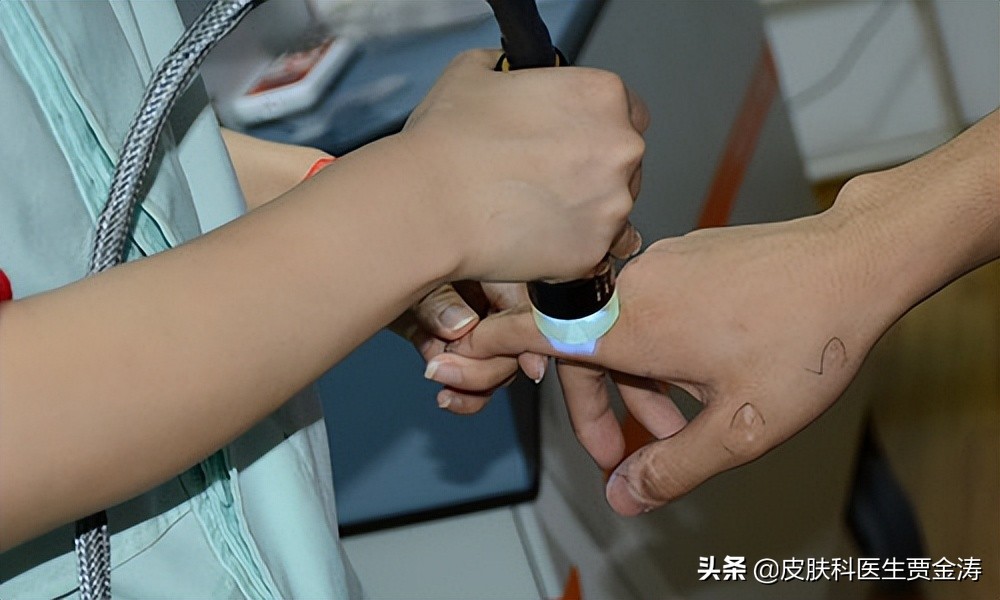 中医治疗白癜风成功案例有吗,白癜风中医还是西医治疗效果好