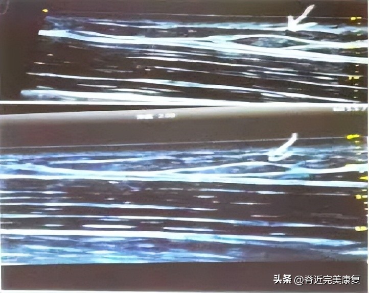 久卧背疼怎么办,总是背痛中医如何调理