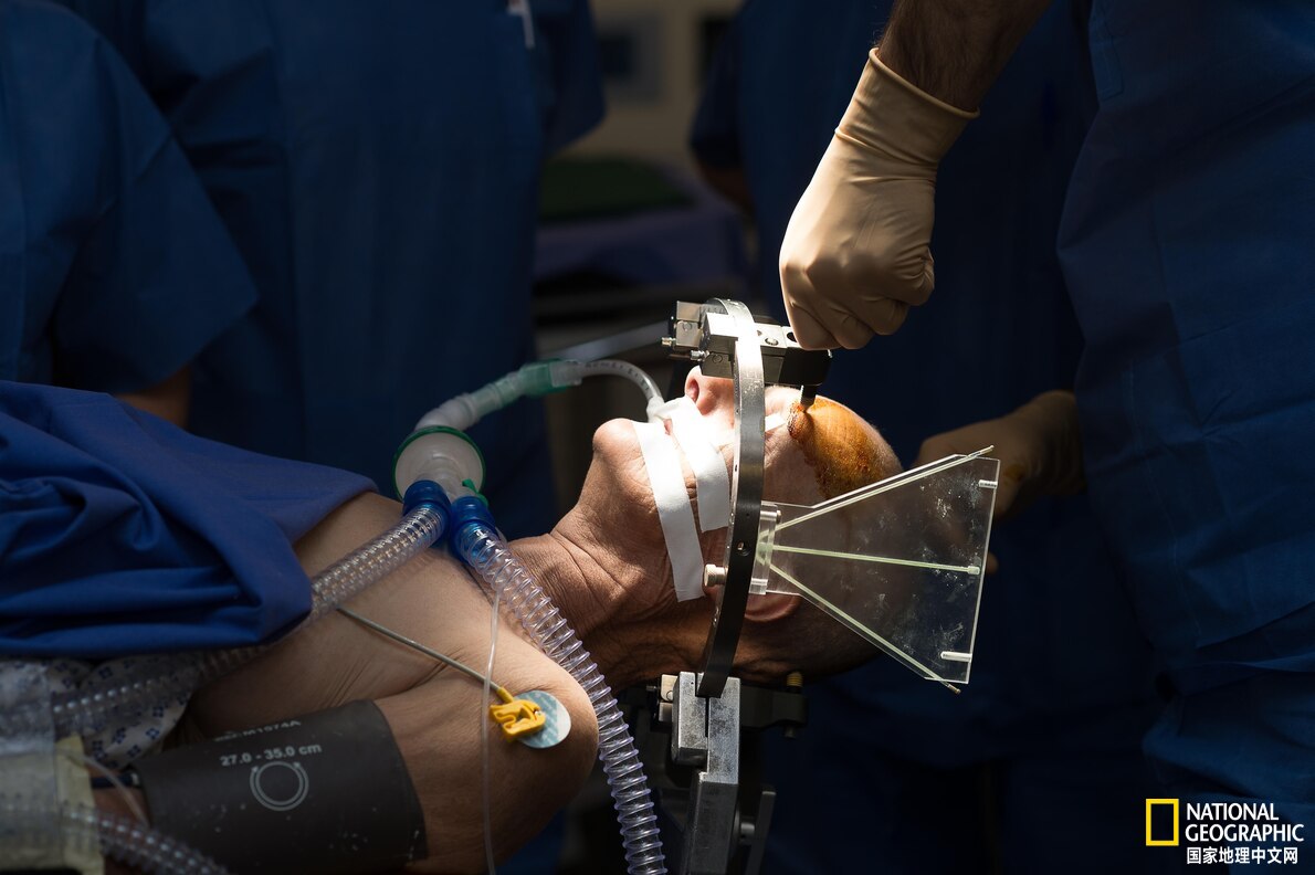 利用电极代替药物治疗疾病？这个可以有