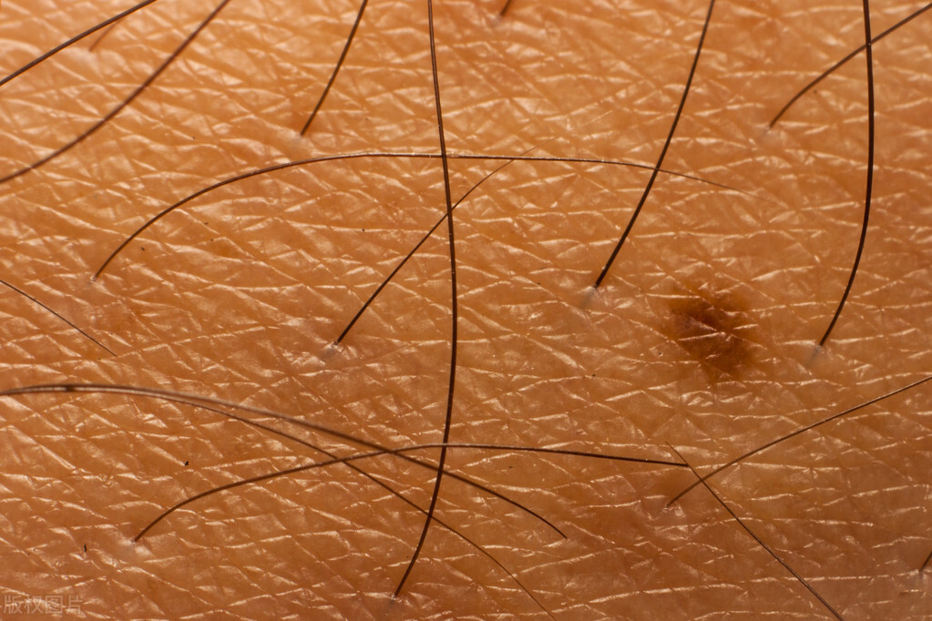 肛毛和阴毛有何区别，肛毛可以剪掉吗？医生直言：它还有2个好处