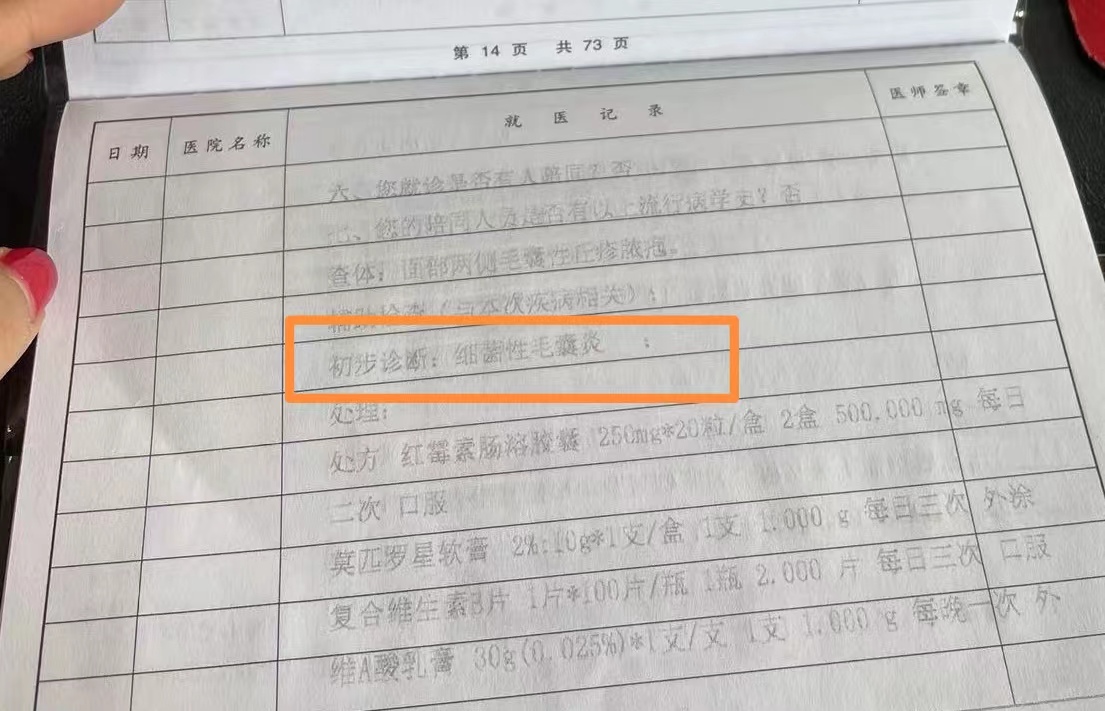 鎵撶編瀹归拡鎰熸煋缁嗚弻,鎵撶編瀹归拡缁嗚弻鎰熸煋