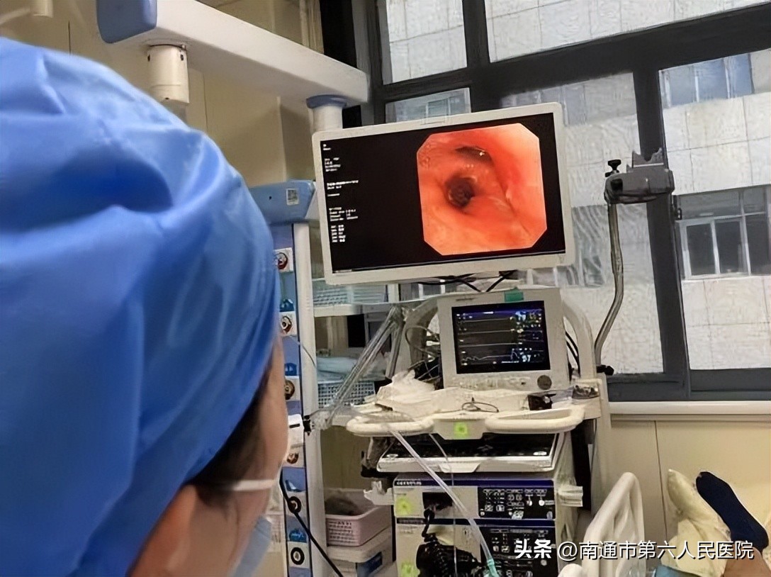 小镜子，大用途，一探究“镜”