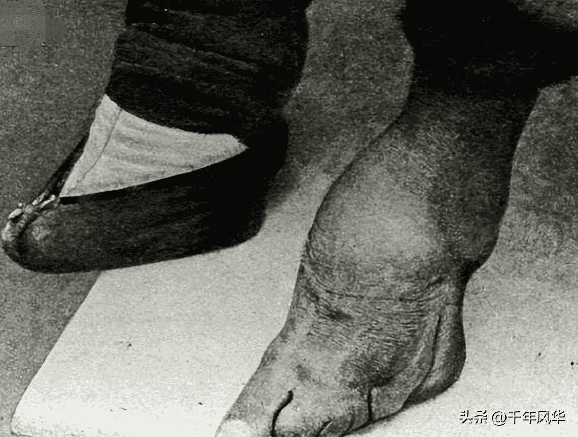 日军日记：*安妇慰**不服从管教，我很愤怒，用*刀刺**插入她的*体下**3