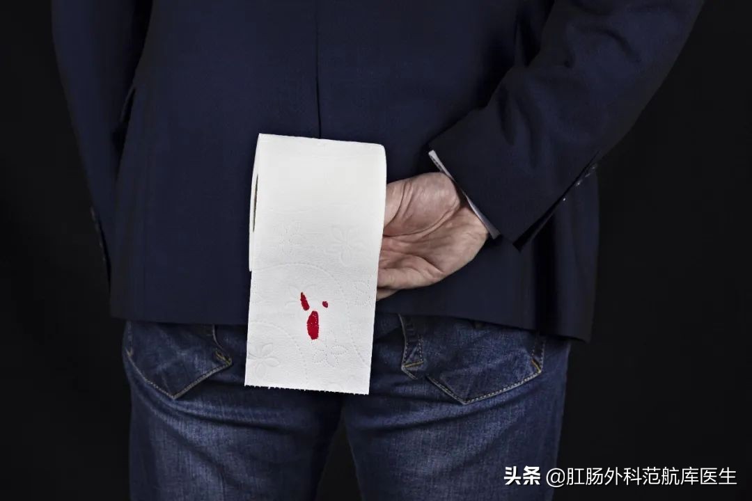 内痔出血用啥药最有效,孕妇内痔出血怎么缓解