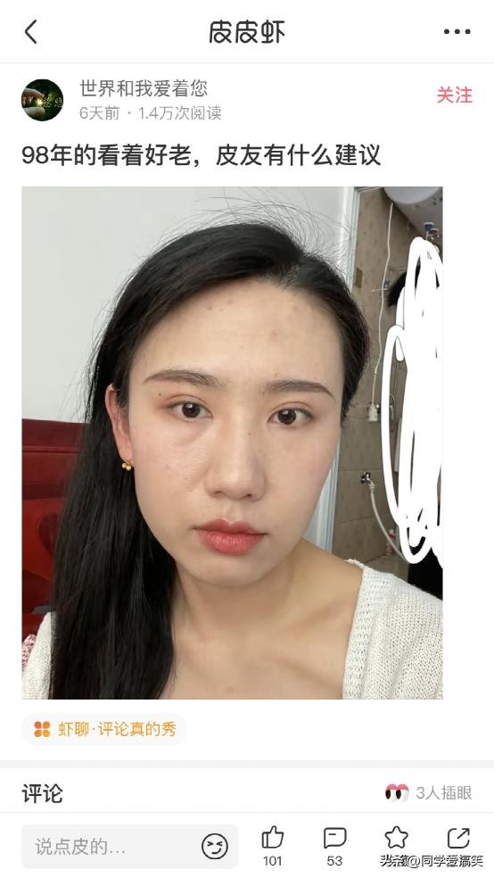 “是小蛇出了轨，还是青蛙劈了腿？”这是现实版的美杜莎？哈哈