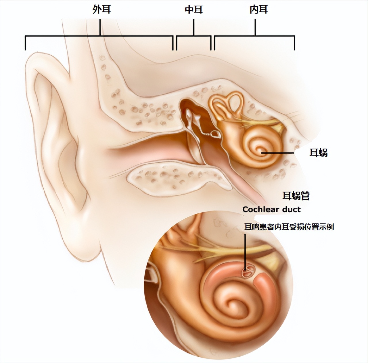 耳朵一直嗡嗡响简单一招解决耳鸣,耳朵嗡嗡响耳鸣什么原因怎么解决