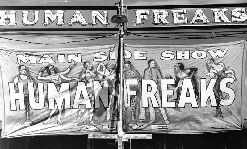 畸形秀背后的真相,畸形秀真实事件