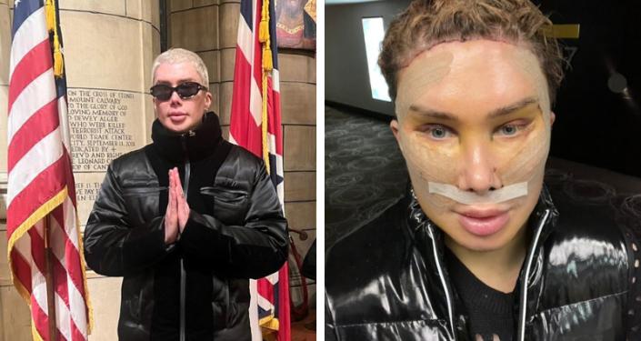 痴迷韩团的英国小哥整成韩国欧巴后又变成韩国女性，如今却后悔了