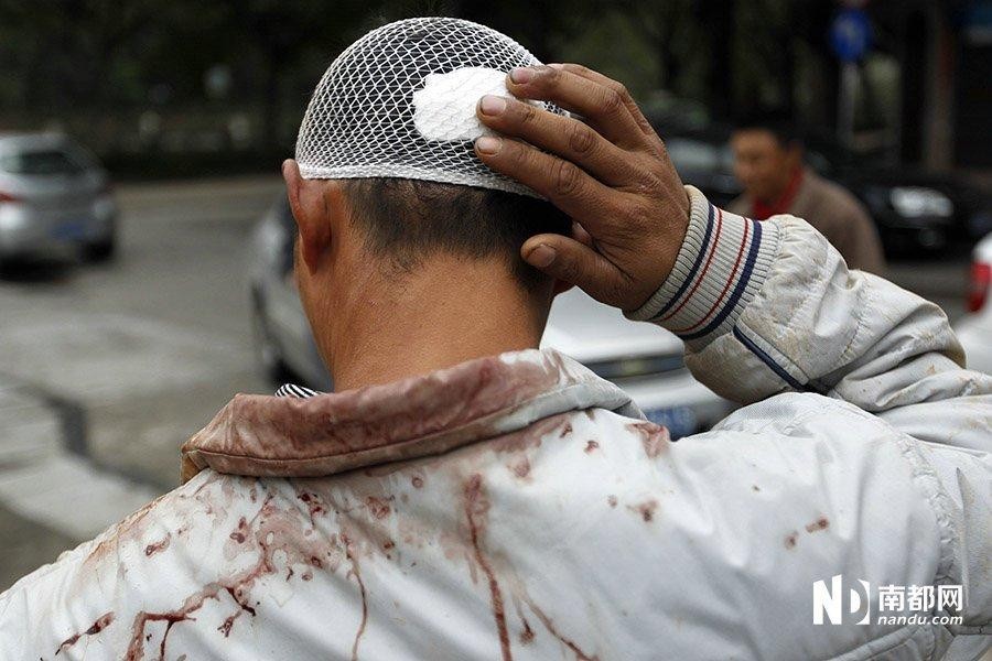 撞到后脑勺了要注意什么,撞到头要注意哪些事项