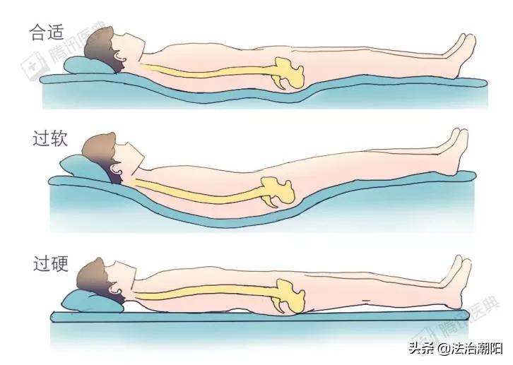 腰椎间盘突出睡硬板床更痛怎么办,睡软床得了腰椎间盘突出