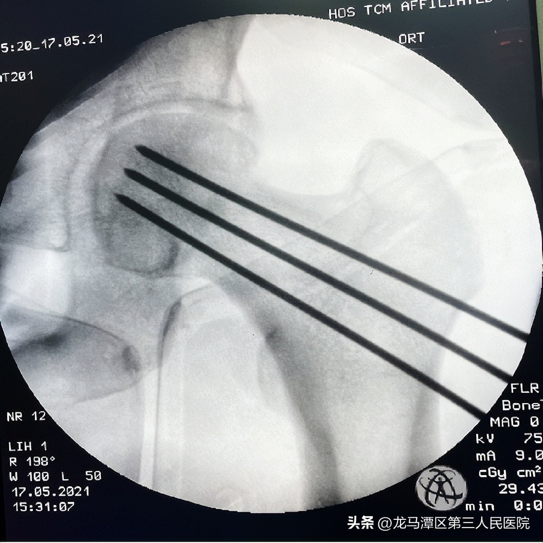 【专家讲堂】区三人医郝琦副教授受邀中国中西结合学会国家继续教育项目