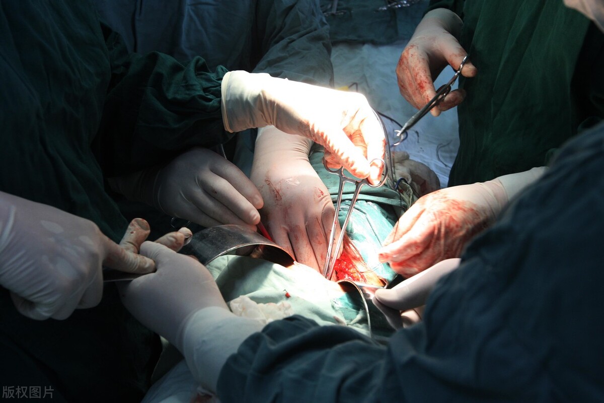 个税税前允许扣除的项目和标准,年金个税税前扣除项目