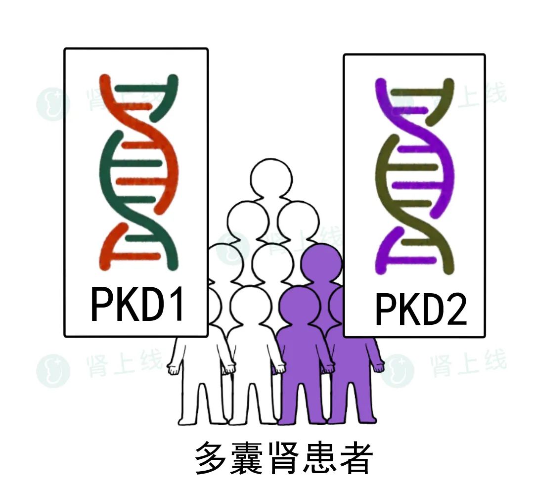 一家接连患尿毒症，是怎么回事？了解最常见的遗传性肾病-多囊肾
