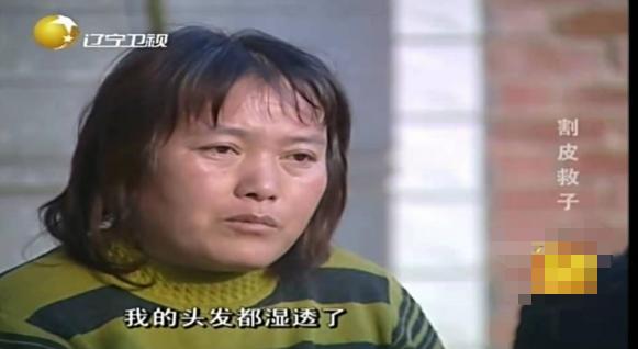 切肤之爱真实上演，河北妈妈割皮救子，就算割光全身的皮也不怕