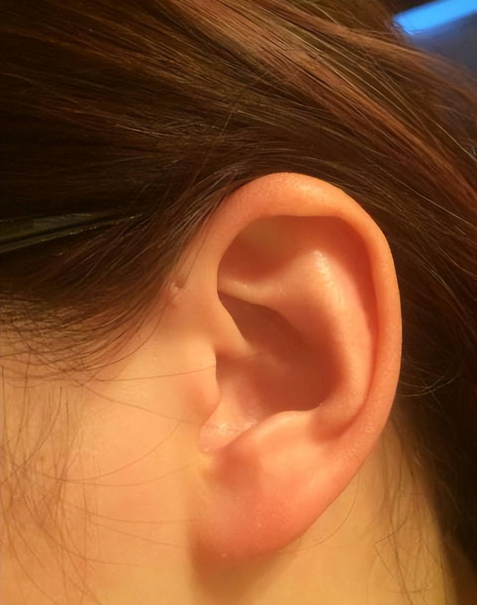 穷人耳富人耳有没有科学依据,穷人耳朵和富人耳朵有什么区别