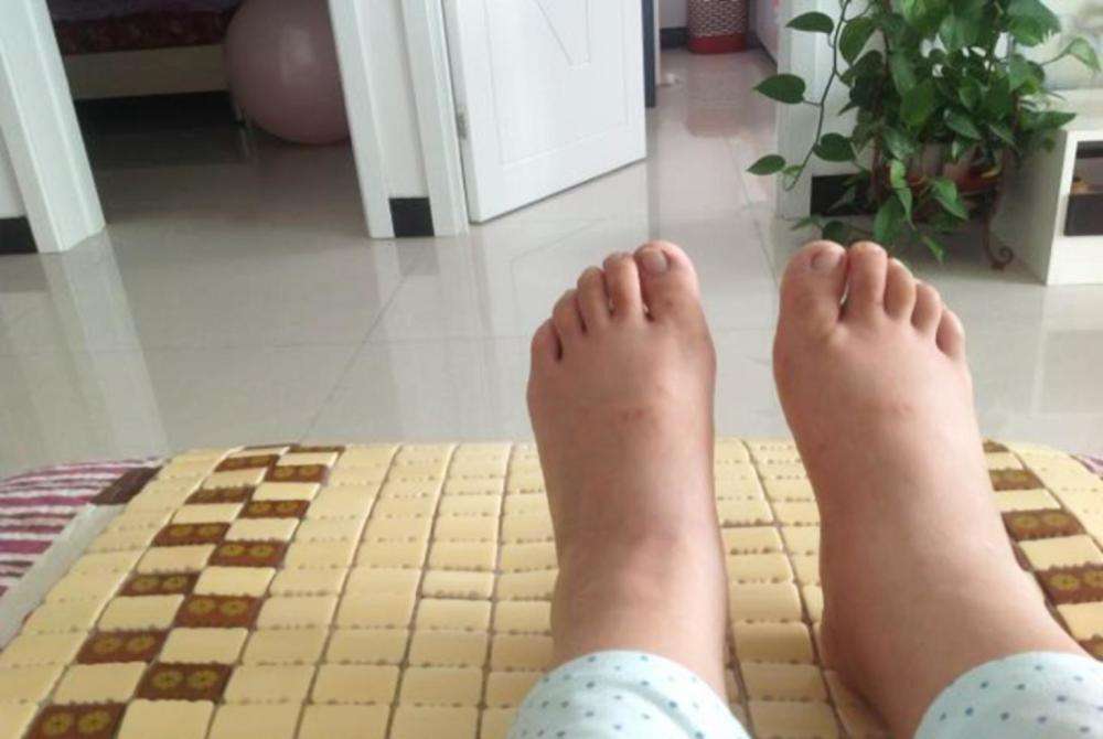 孕期“尴尬事”你经历过几个？现给出化解之法，助你安然度过孕期