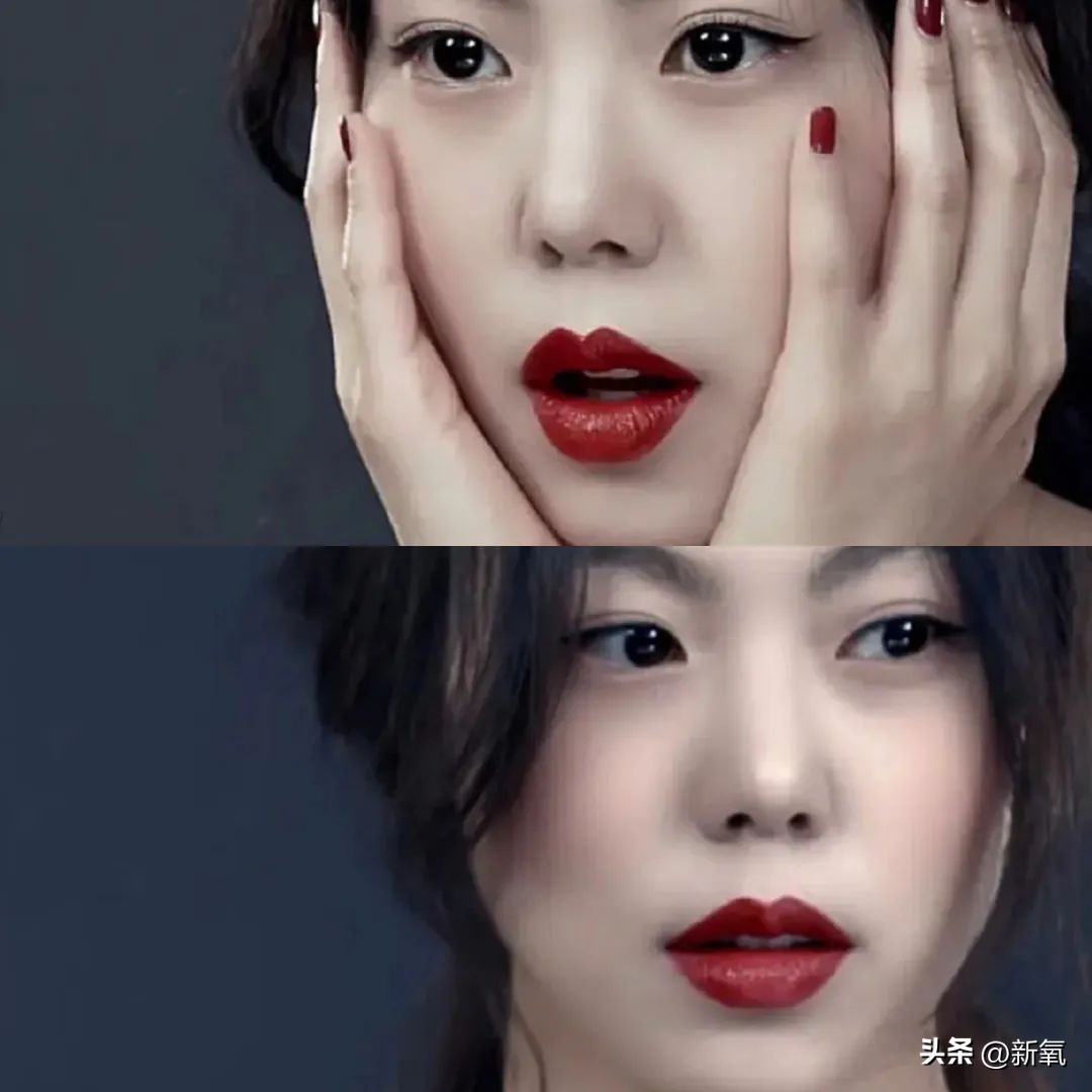 嘴唇薄变丰满,嘴唇变凸变丑怎么办