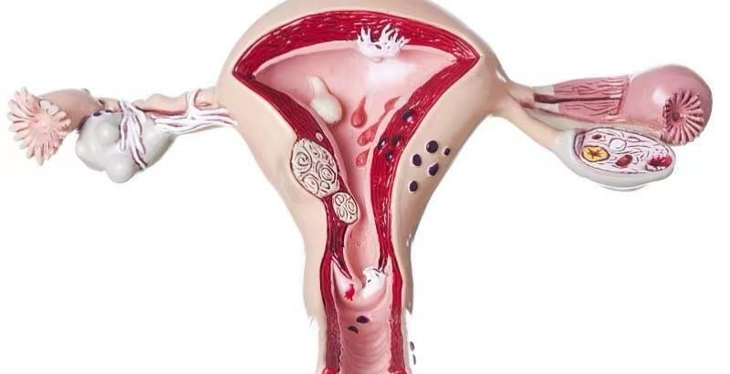 避孕措施安全套,女性使用的避孕措施