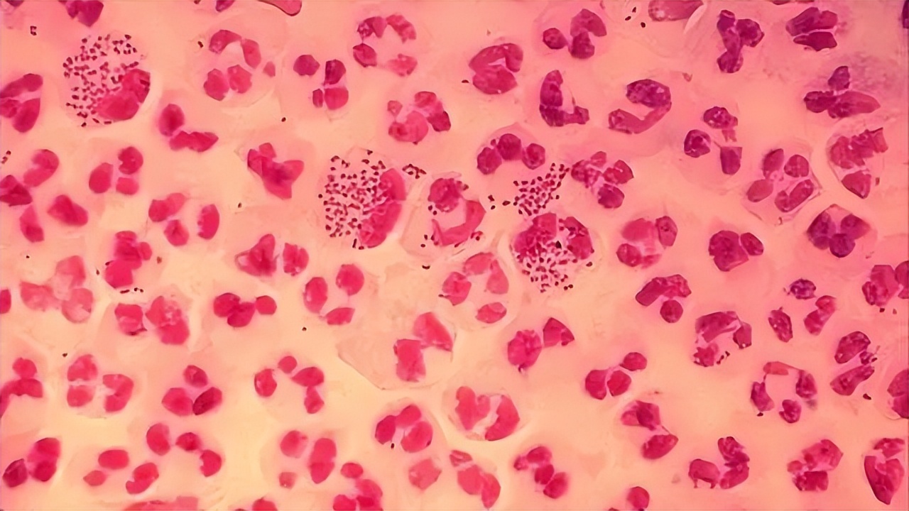 嘴巴周围有好多小水泡是上火吗,嘴上上火长水泡会传染吗