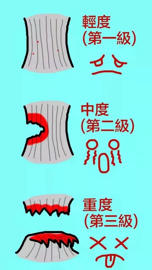腿关节内侧韧带拉伤是什么症状,膝盖肌肉拉伤和膝盖韧带拉伤症状