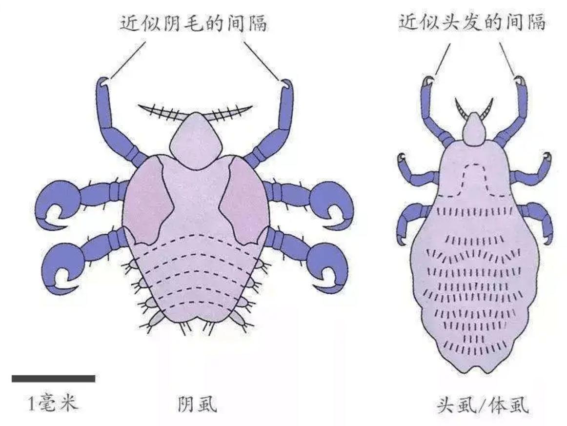 和人类共同进化的虱子，30多年前很常见，现在怎么看不到了？