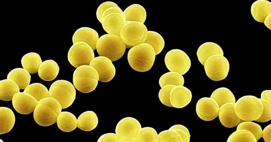 抗氧化防晒内服,抗氧的防晒成分有哪些