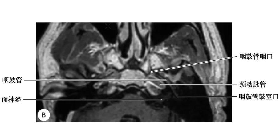 耳部解剖结构和生理功能,耳部解剖笔记