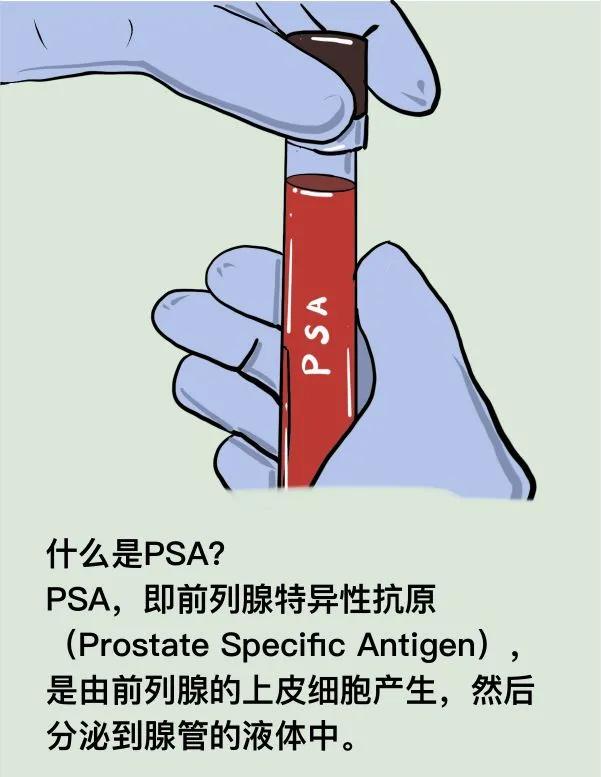 ai检测率多少算比较合适,一滴血测基因预测癌症