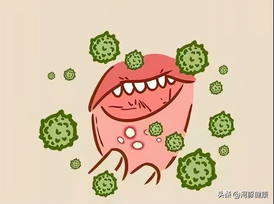 长期口腔溃疡一直不愈是癌吗,口腔溃疡不管它一般几天就能自愈