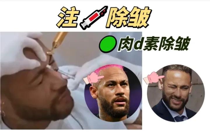 c罗内马尔在一个队吗,内马尔医美项目全过程