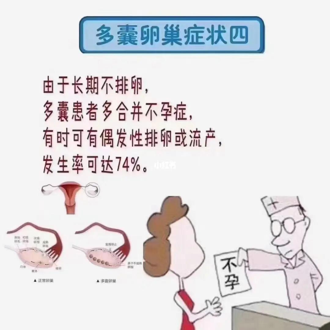 多囊卵巢发病率高吗,多囊卵巢综合征发病率是多少