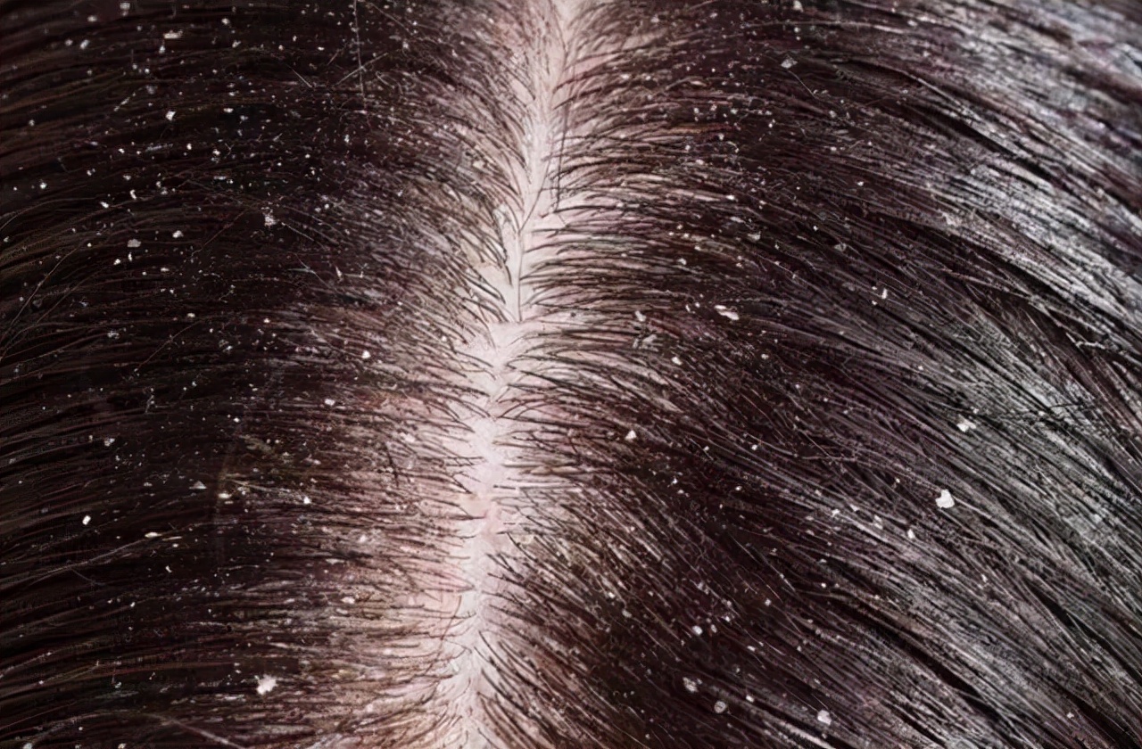 掉的头发根部没有小白点,头发根部小白点掉了还会长吗