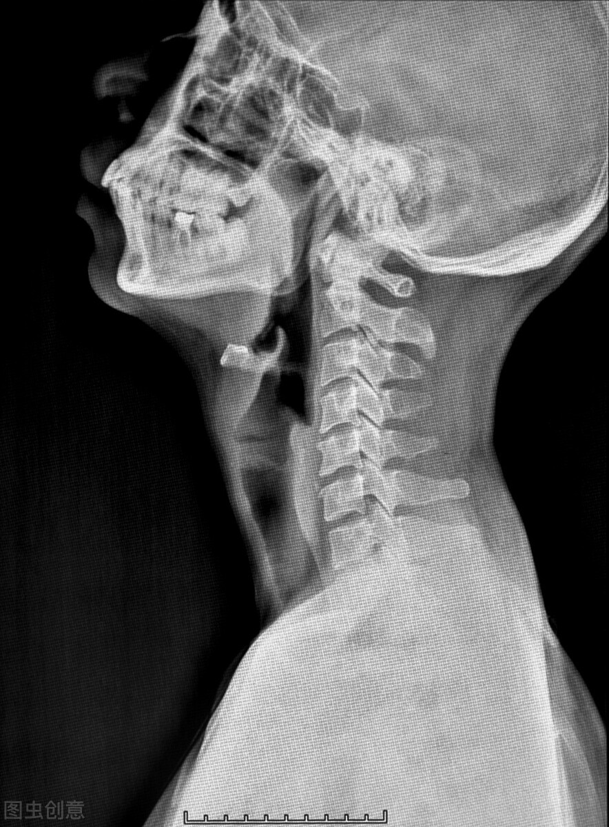 头晕大脑反应迟钝,头晕眼花颈椎难受怎么回事