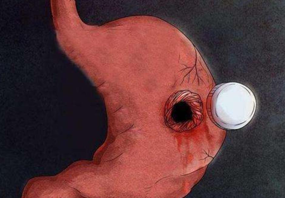 男医生给女朋友做肠镜,有男医生给女性做肠镜吗